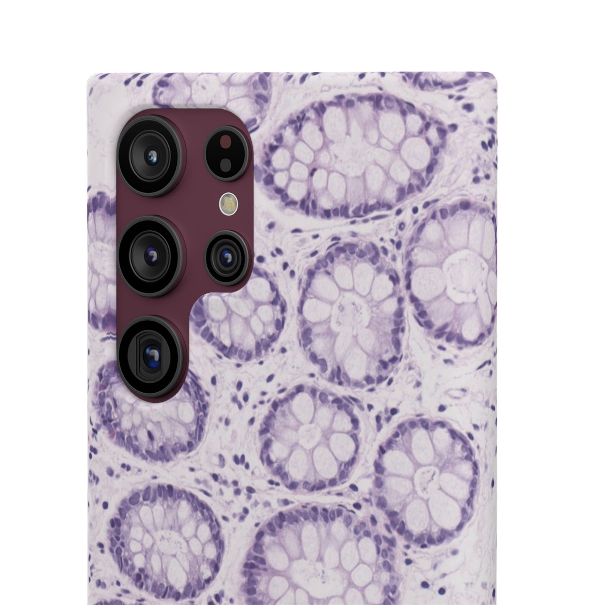 Slim Case Kolon