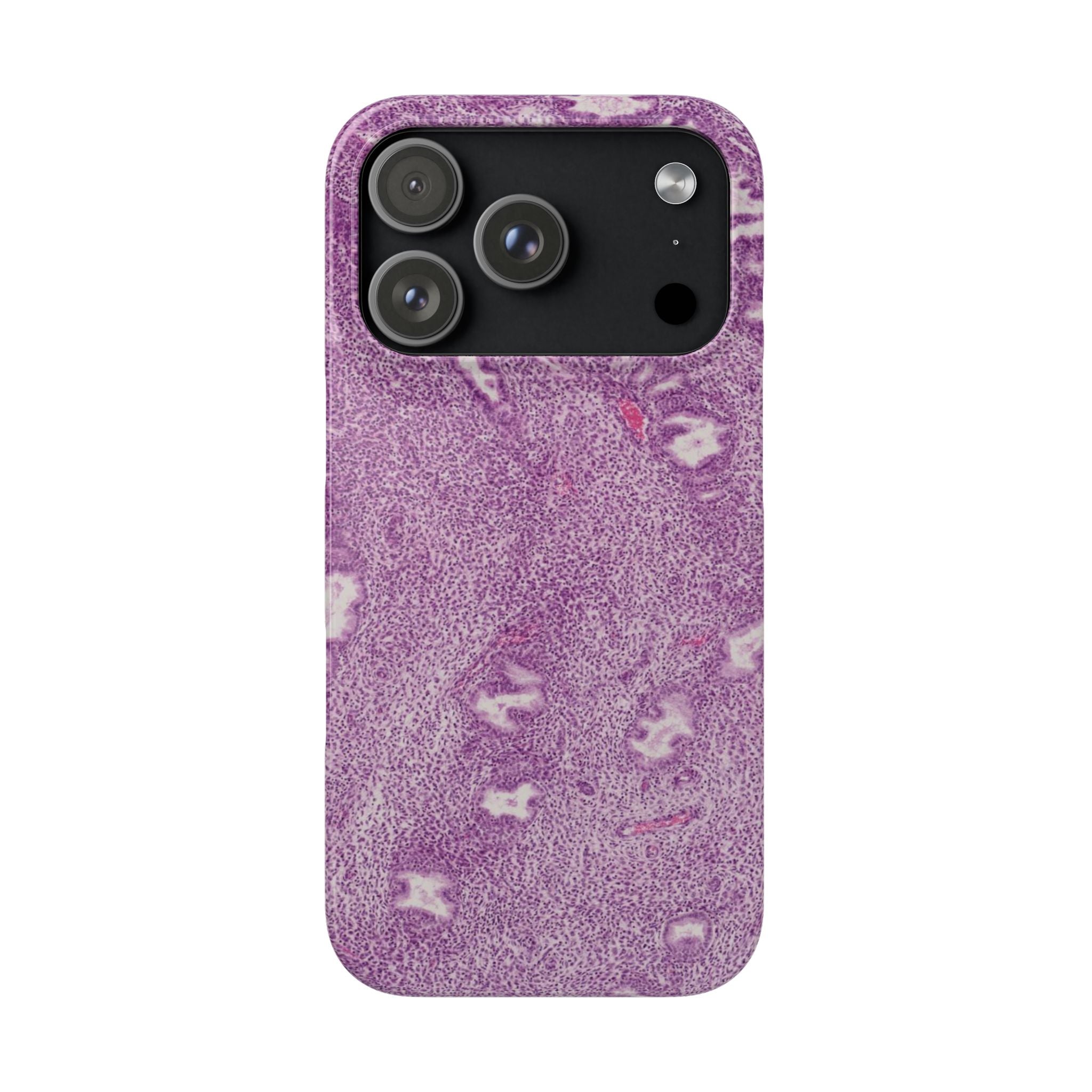 Slim Case Endometrium