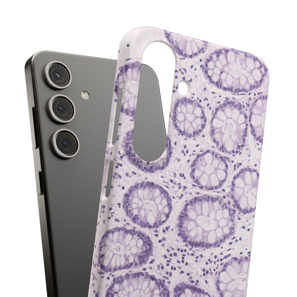 Slim Case Kolon