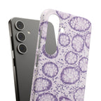 Slim Case Kolon