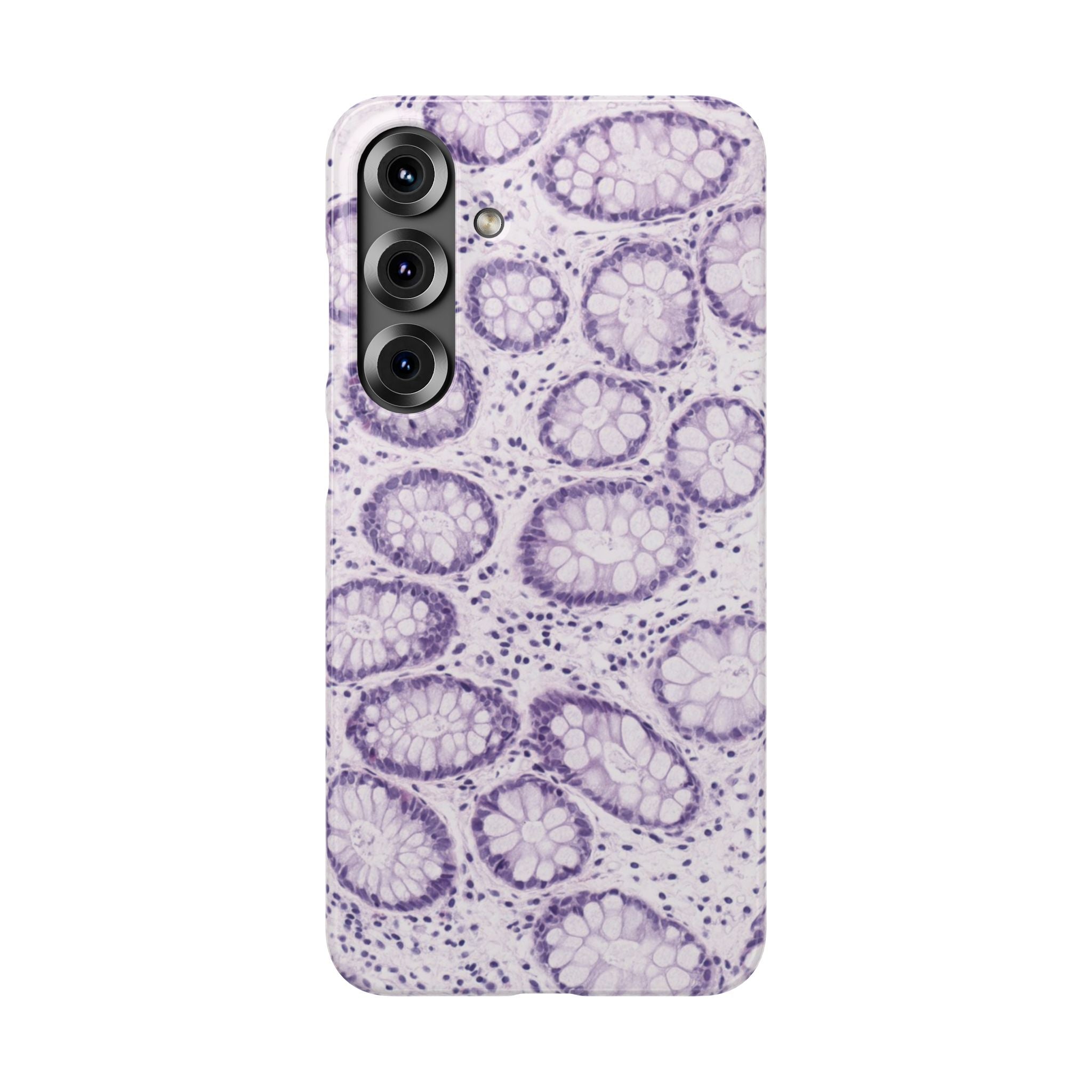 Slim Case Kolon