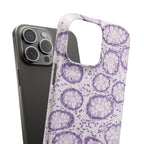 Slim Case Kolon