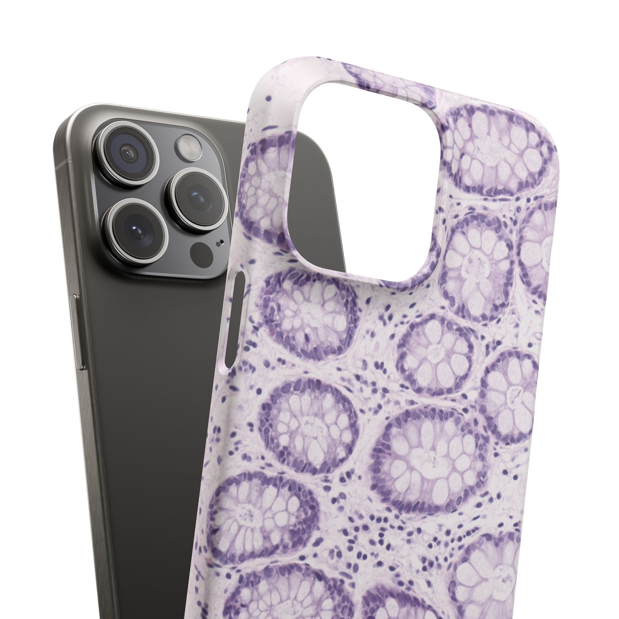 Slim Case Kolon