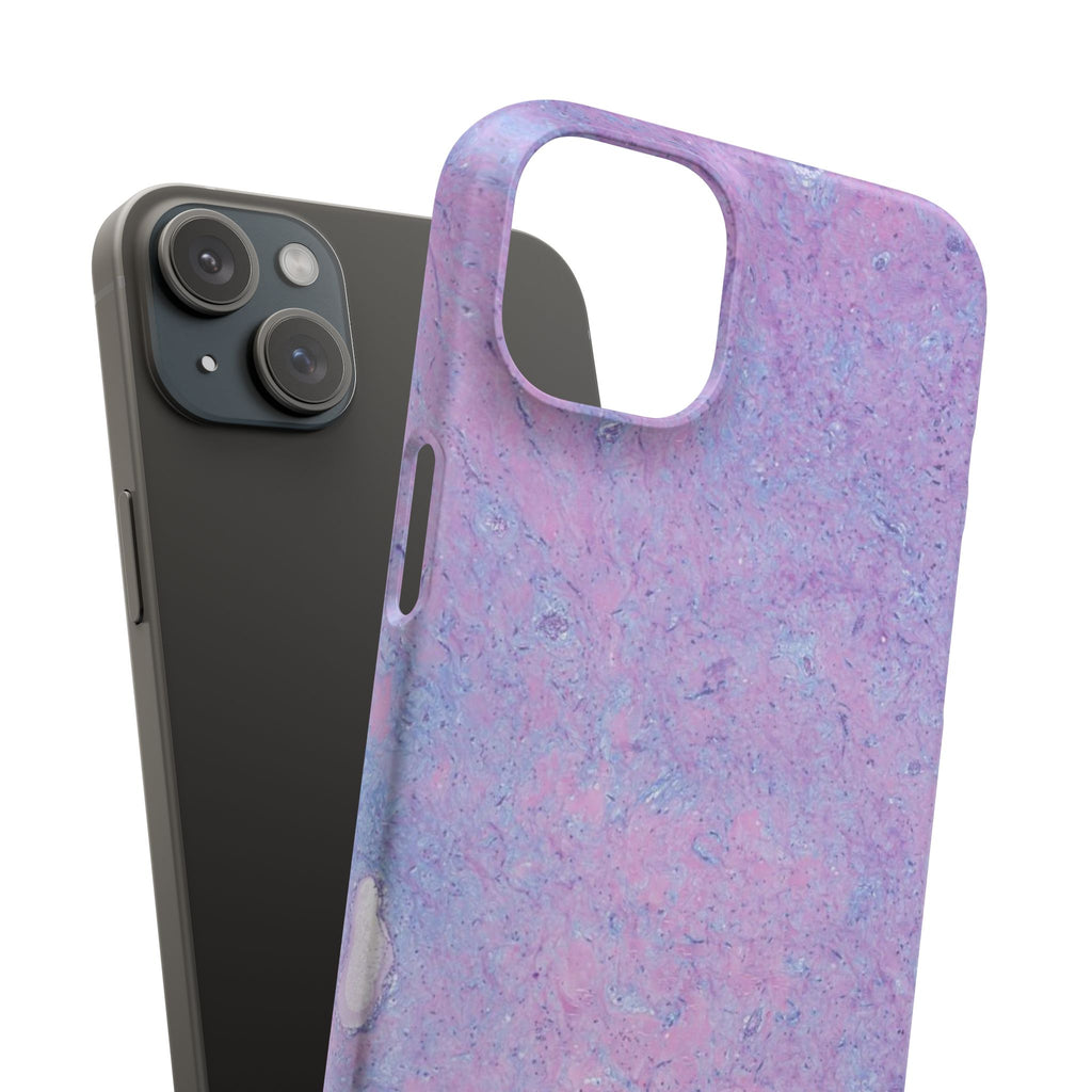 Slim Case Arterielles Myxom