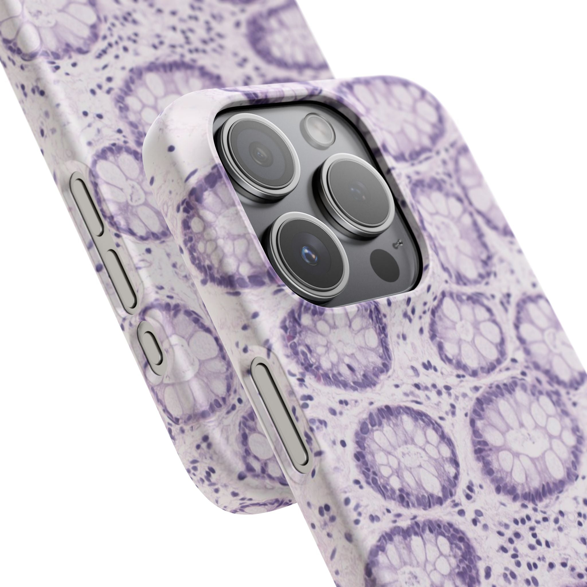 Slim Case Kolon