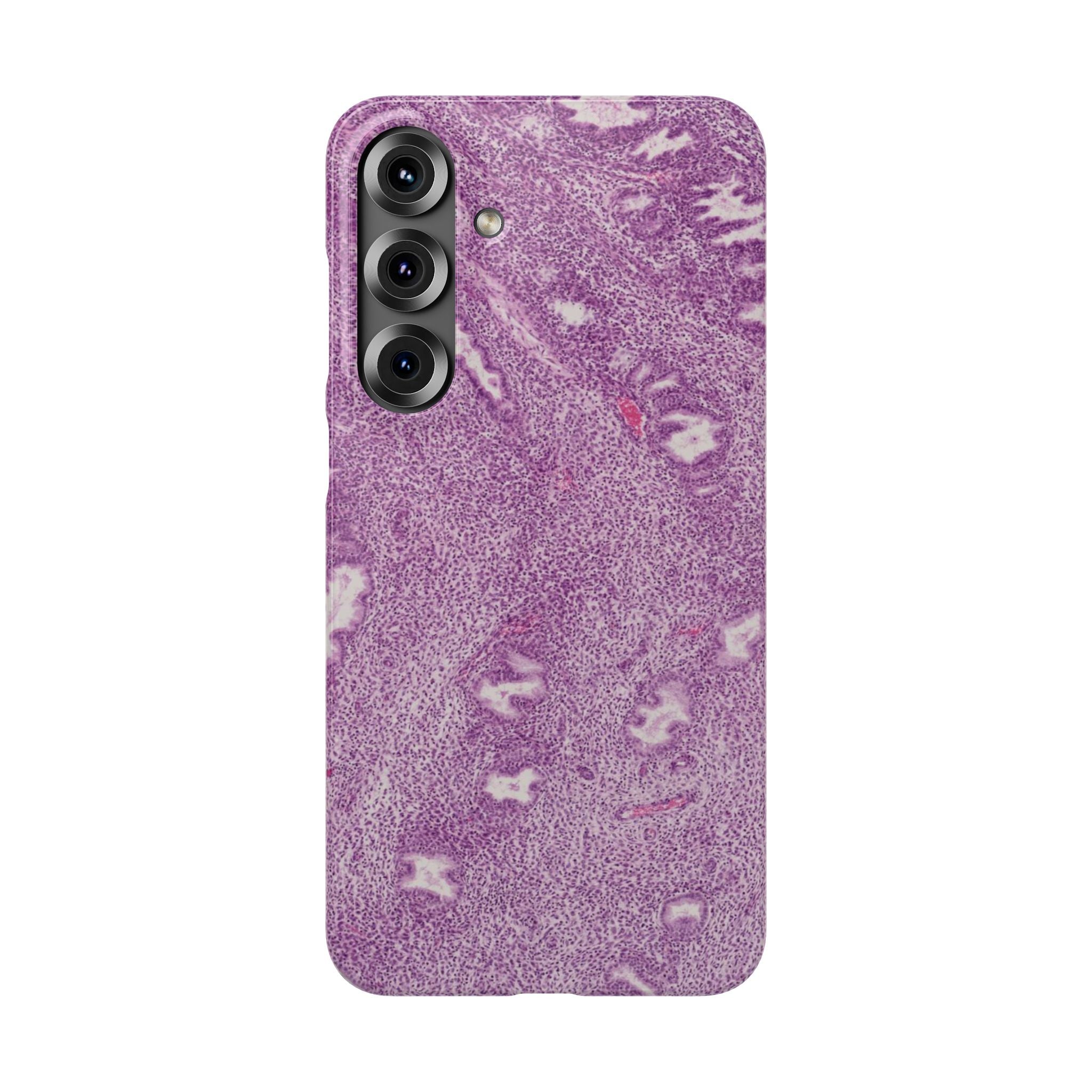 Slim Case Endometrium