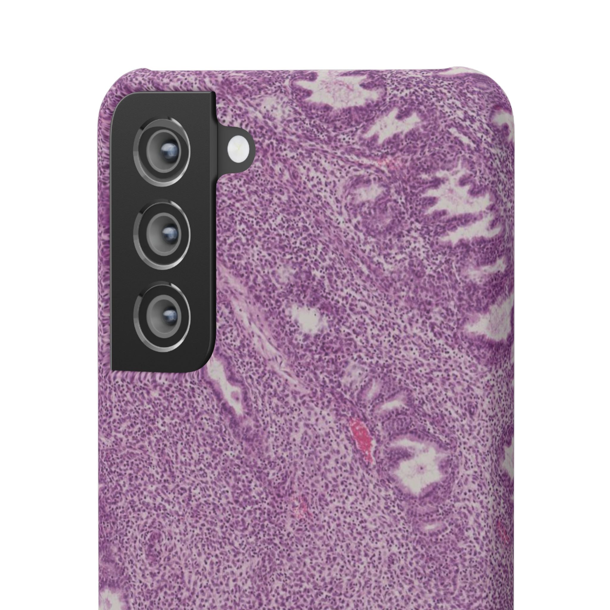 Slim Case Endometrium