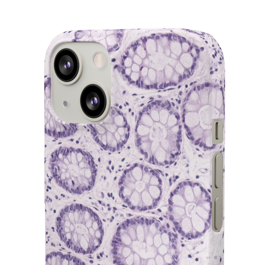 Slim Case Kolon