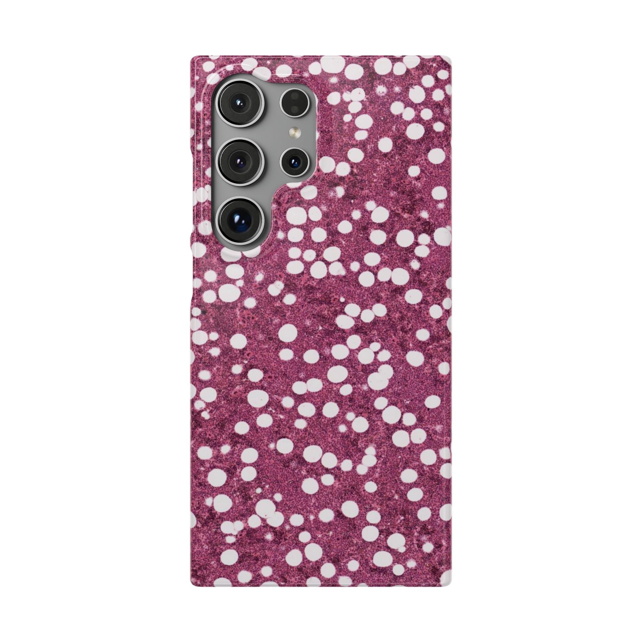 Slim Case Myelolipom