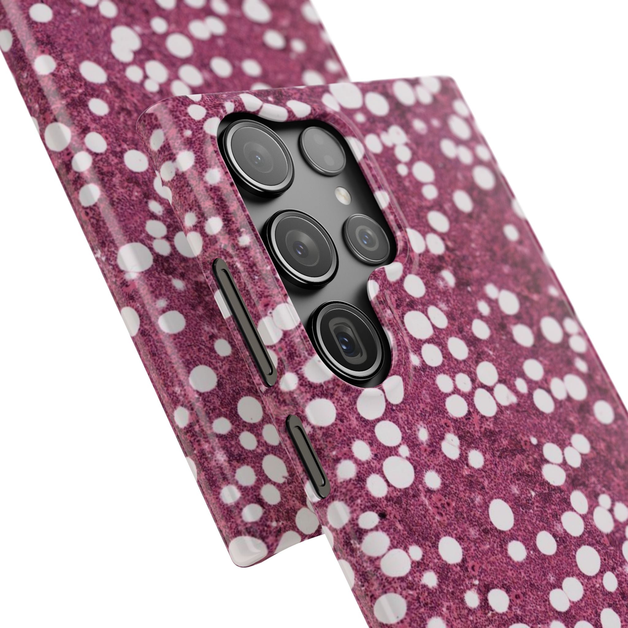 Slim Case Myelolipom