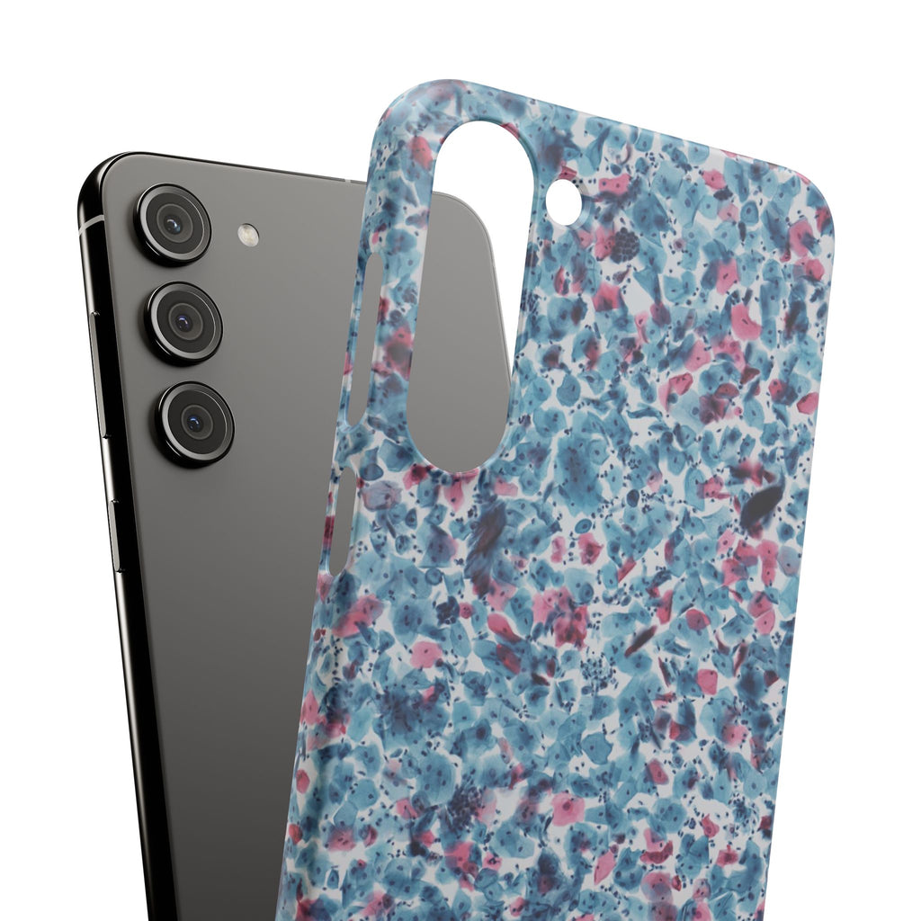 Slim Case PAP