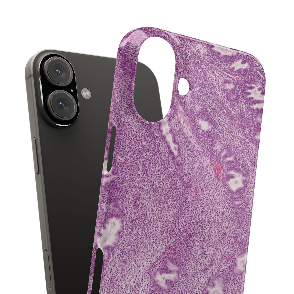 Slim Case Endometrium