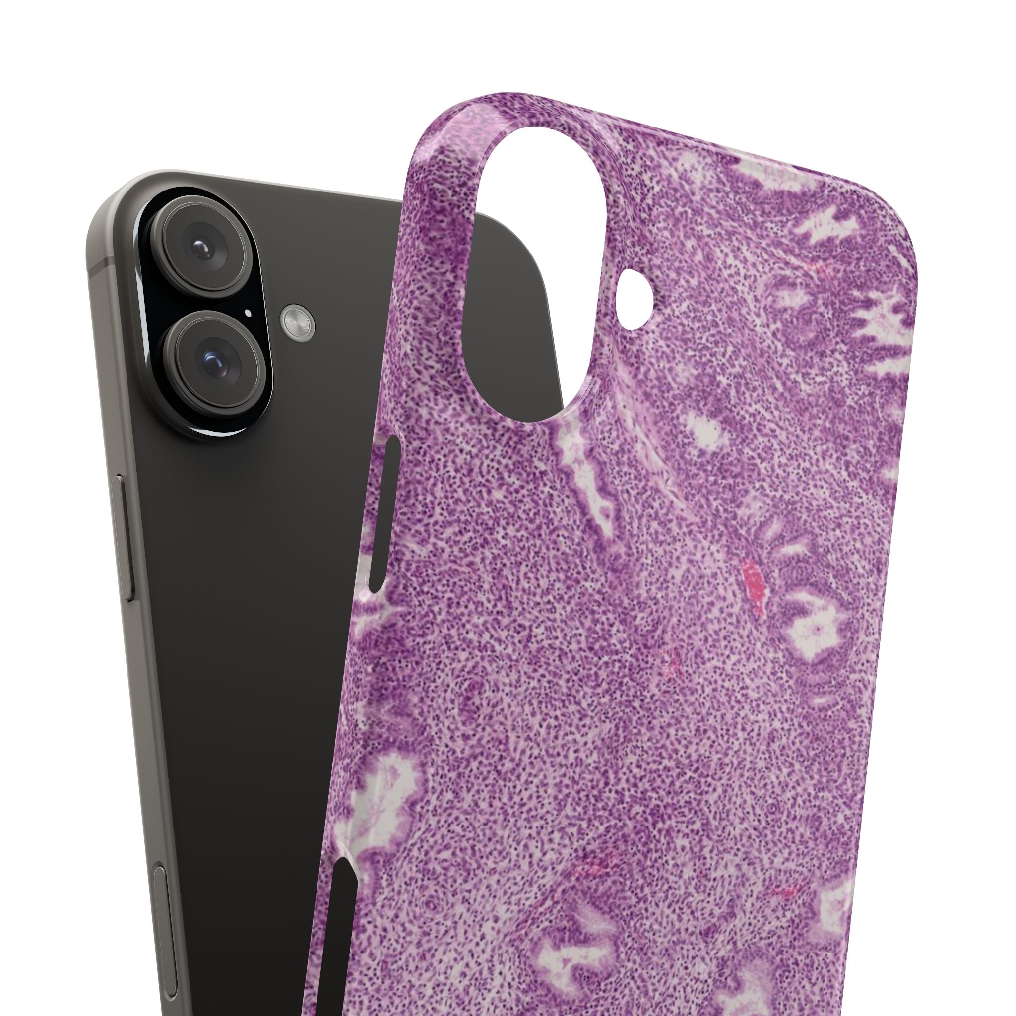 Slim Case Endometrium