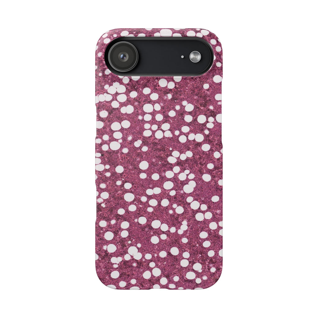 Slim Case Myelolipom