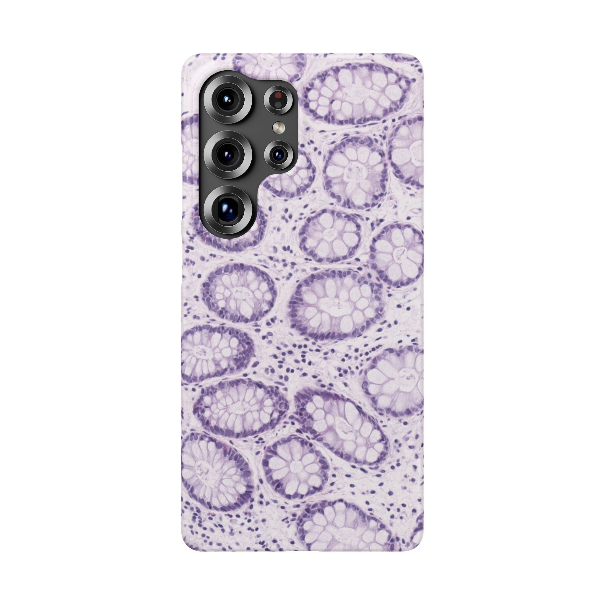 Slim Case Kolon