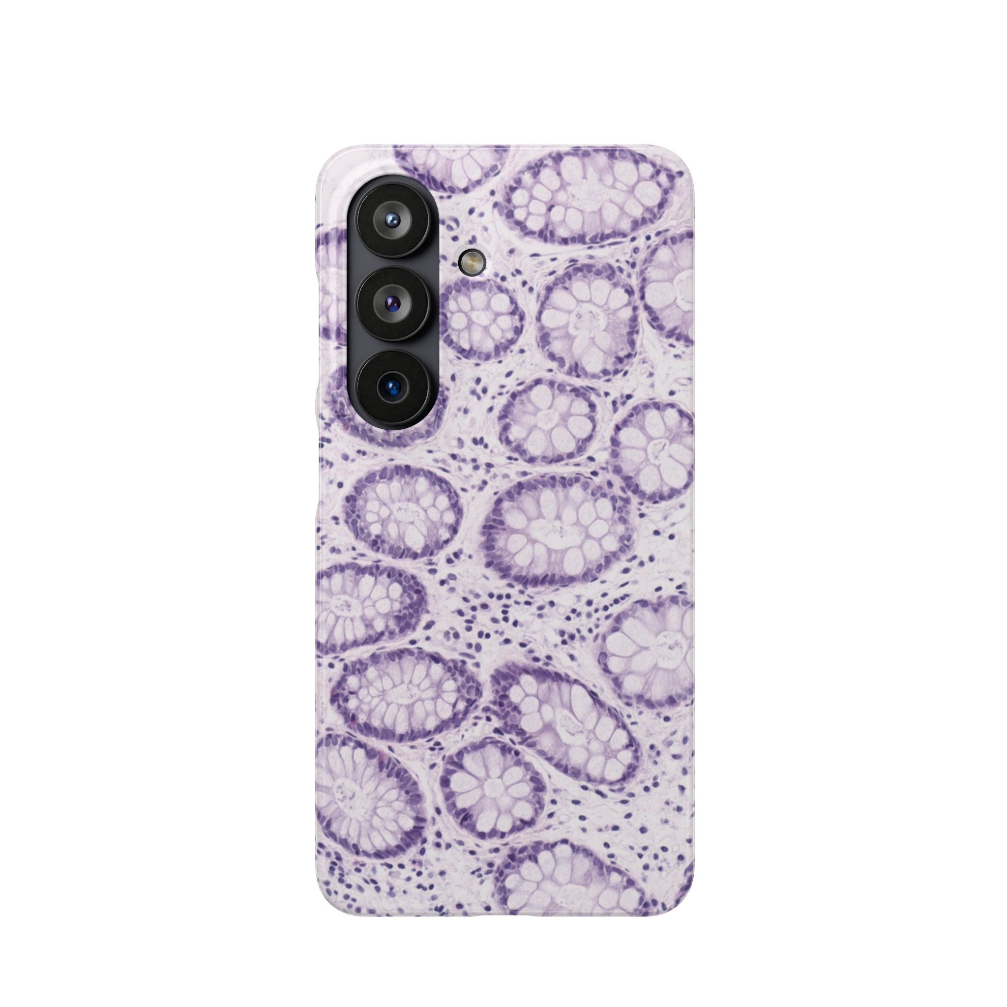 Slim Case Kolon