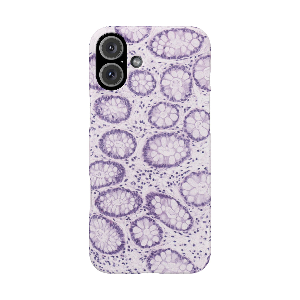 Slim Case Kolon