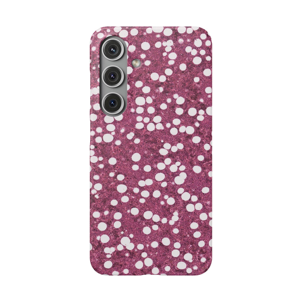 Slim Case Myelolipom
