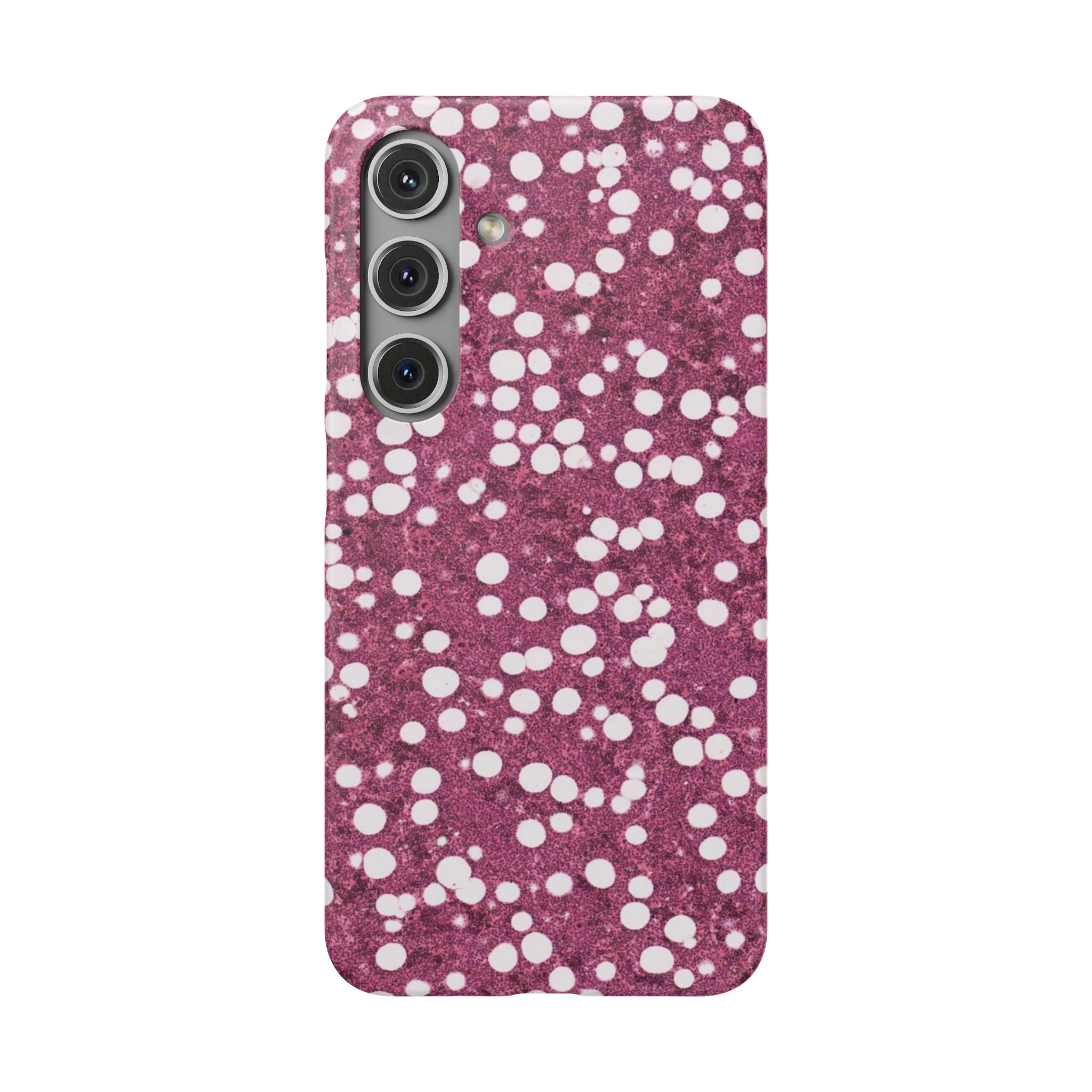 Slim Case Myelolipom