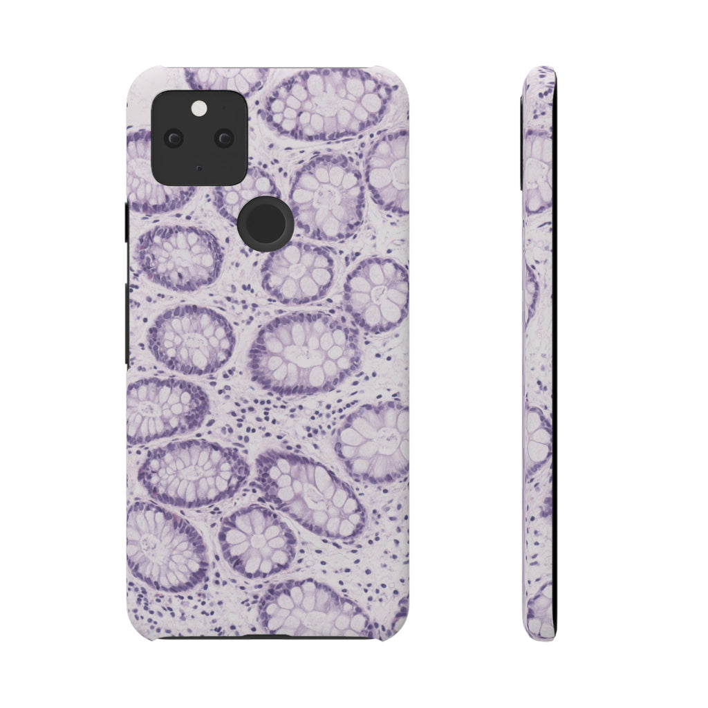 Slim Case Kolon