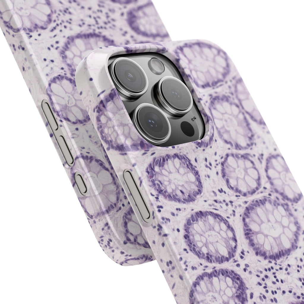 Slim Case Kolon