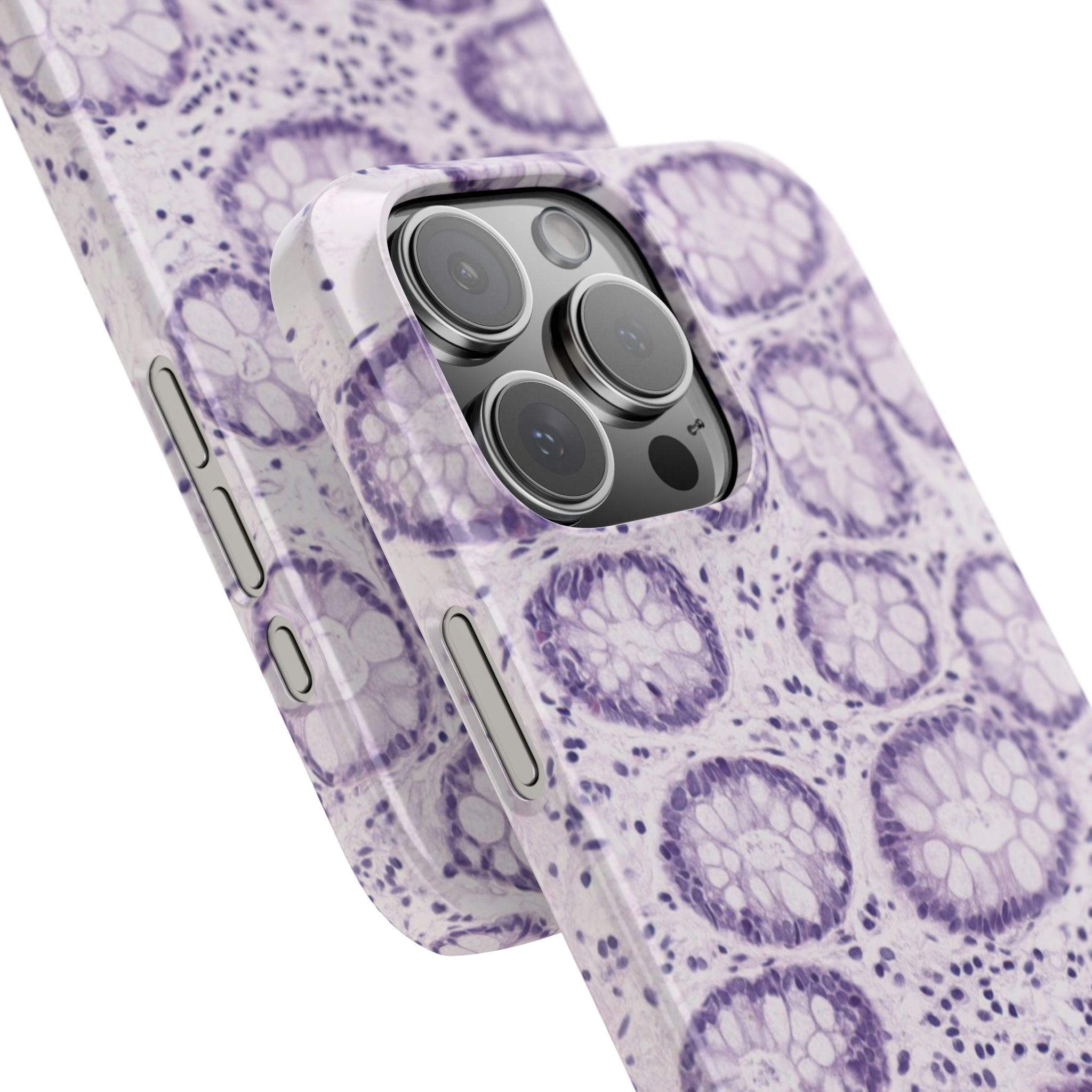 Slim Case Kolon
