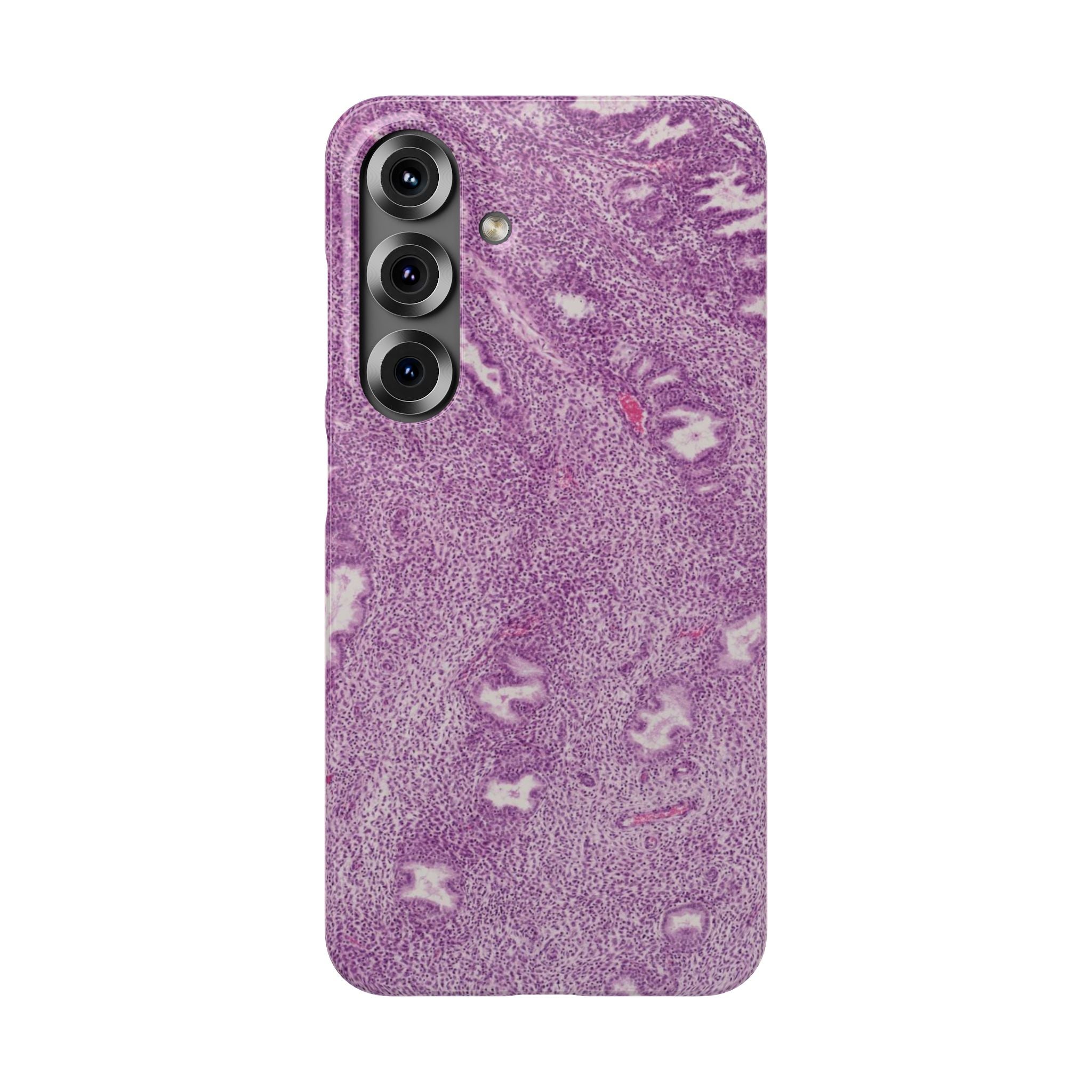 Slim Case Endometrium