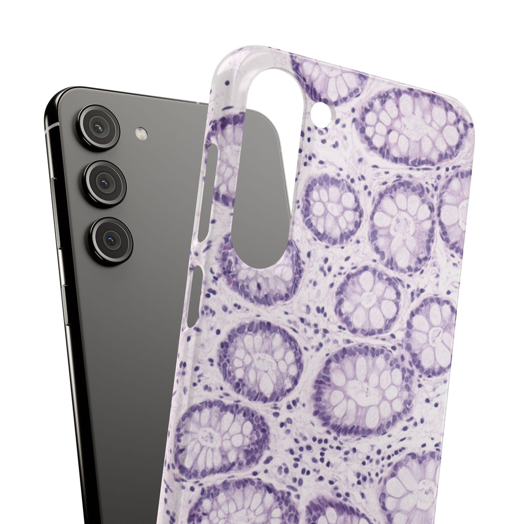 Slim Case Kolon