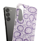 Slim Case Kolon