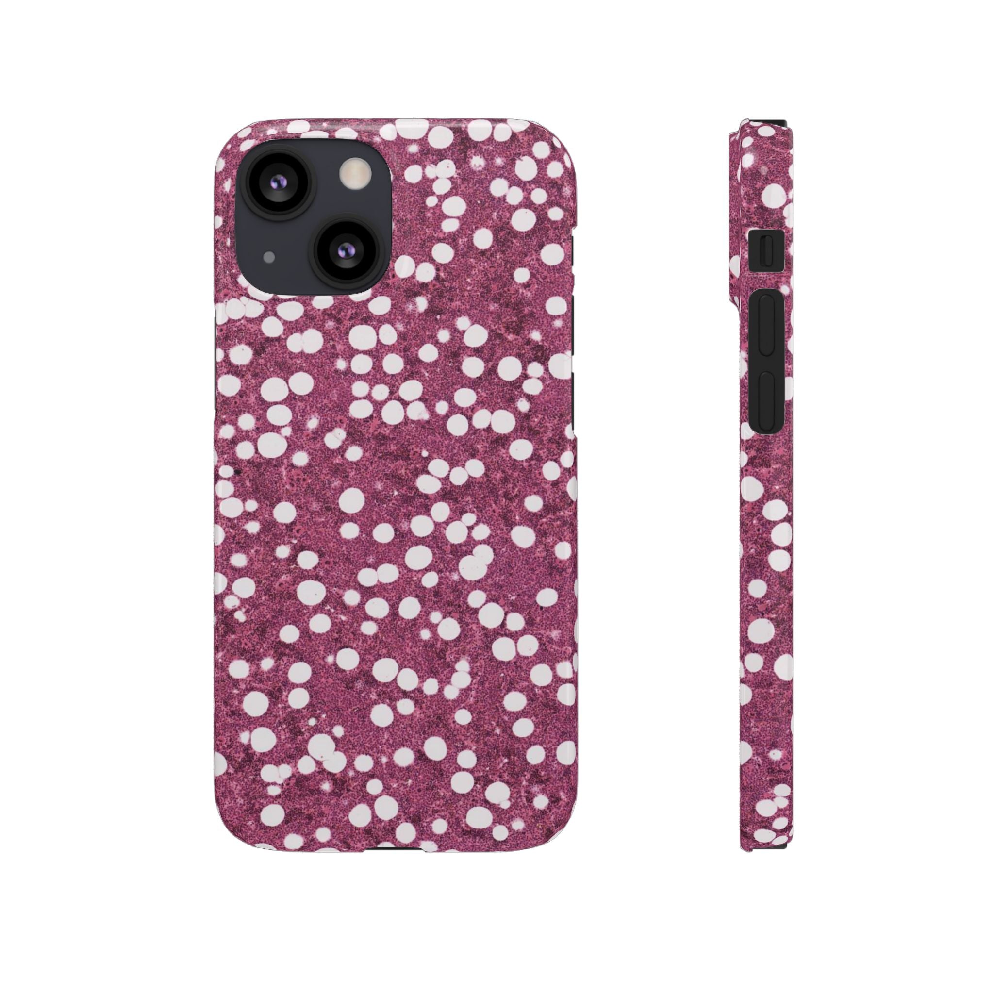 Slim Case Myelolipom