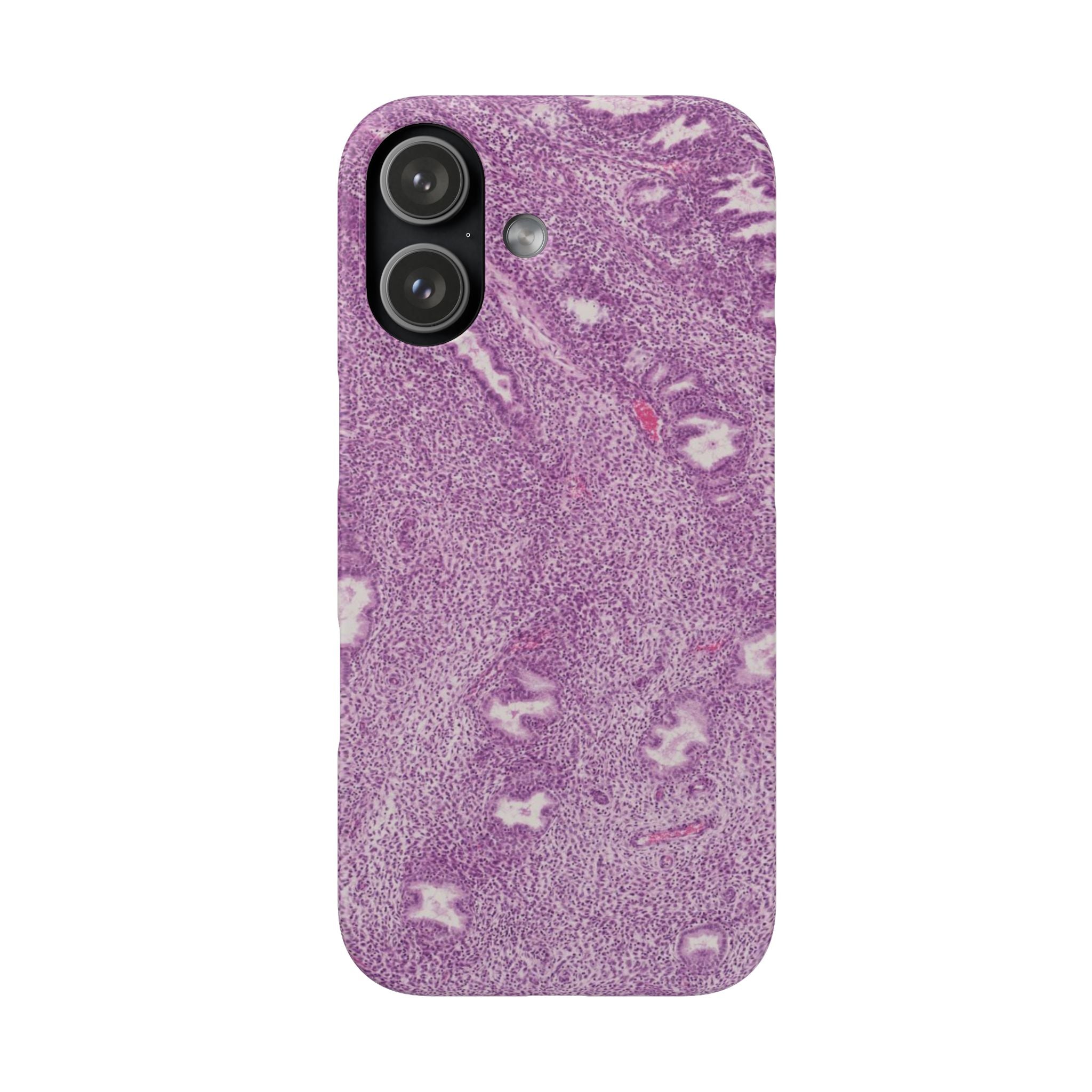 Slim Case Endometrium