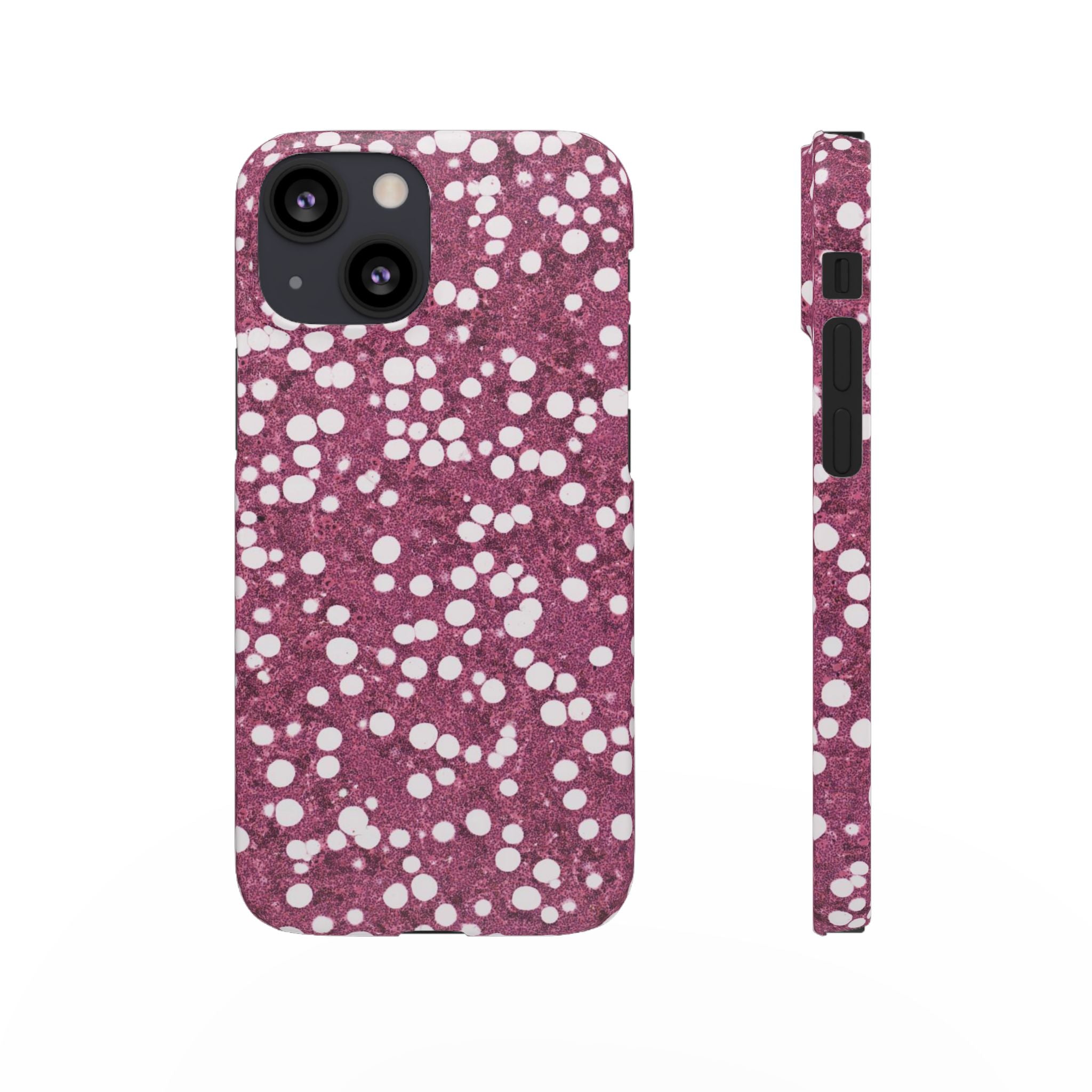 Slim Case Myelolipom