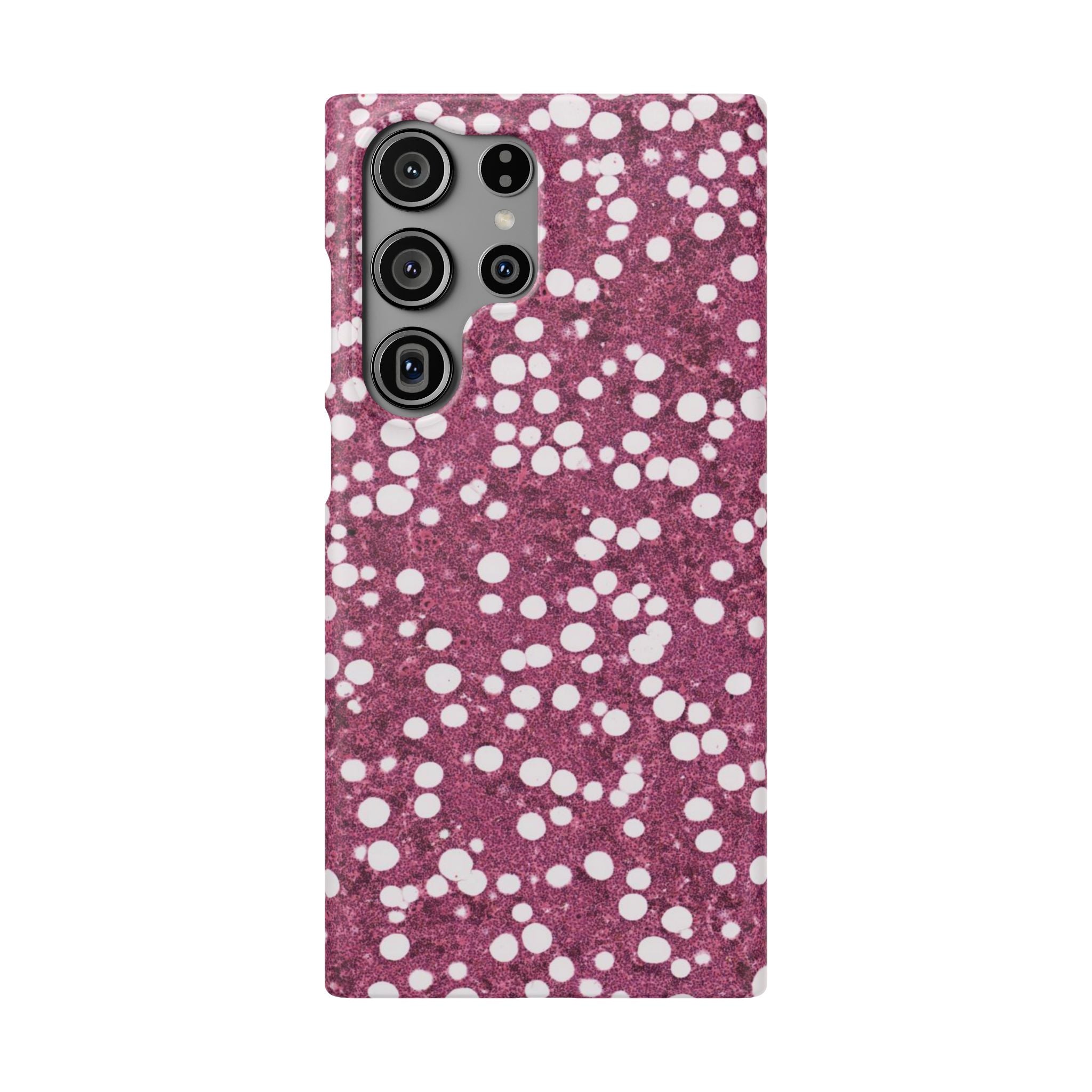 Slim Case Myelolipom
