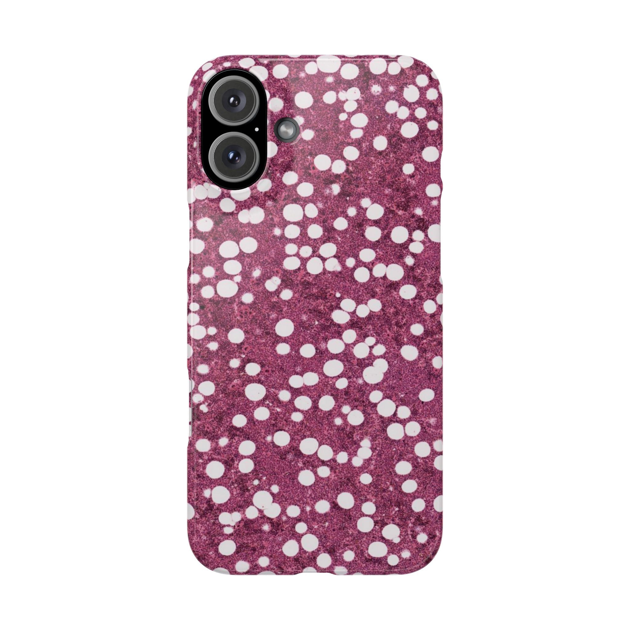 Slim Case Myelolipom