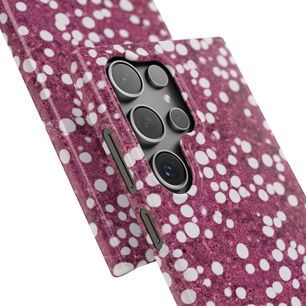 Slim Case Myelolipom