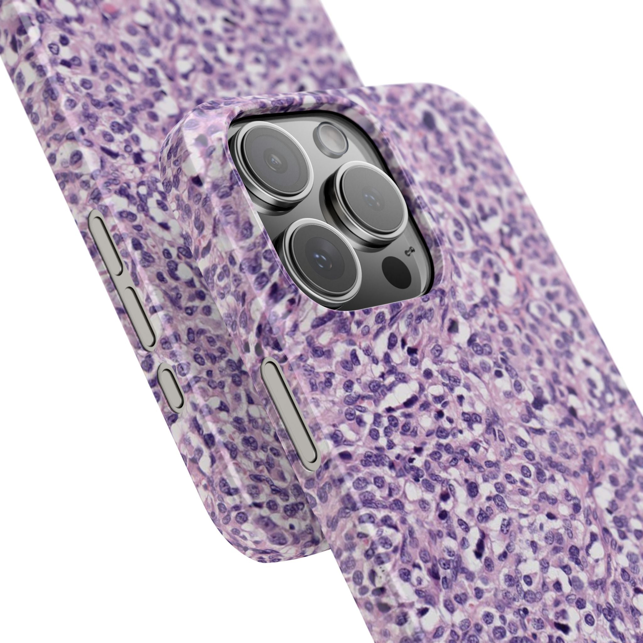 Slim Case Paraganglion
