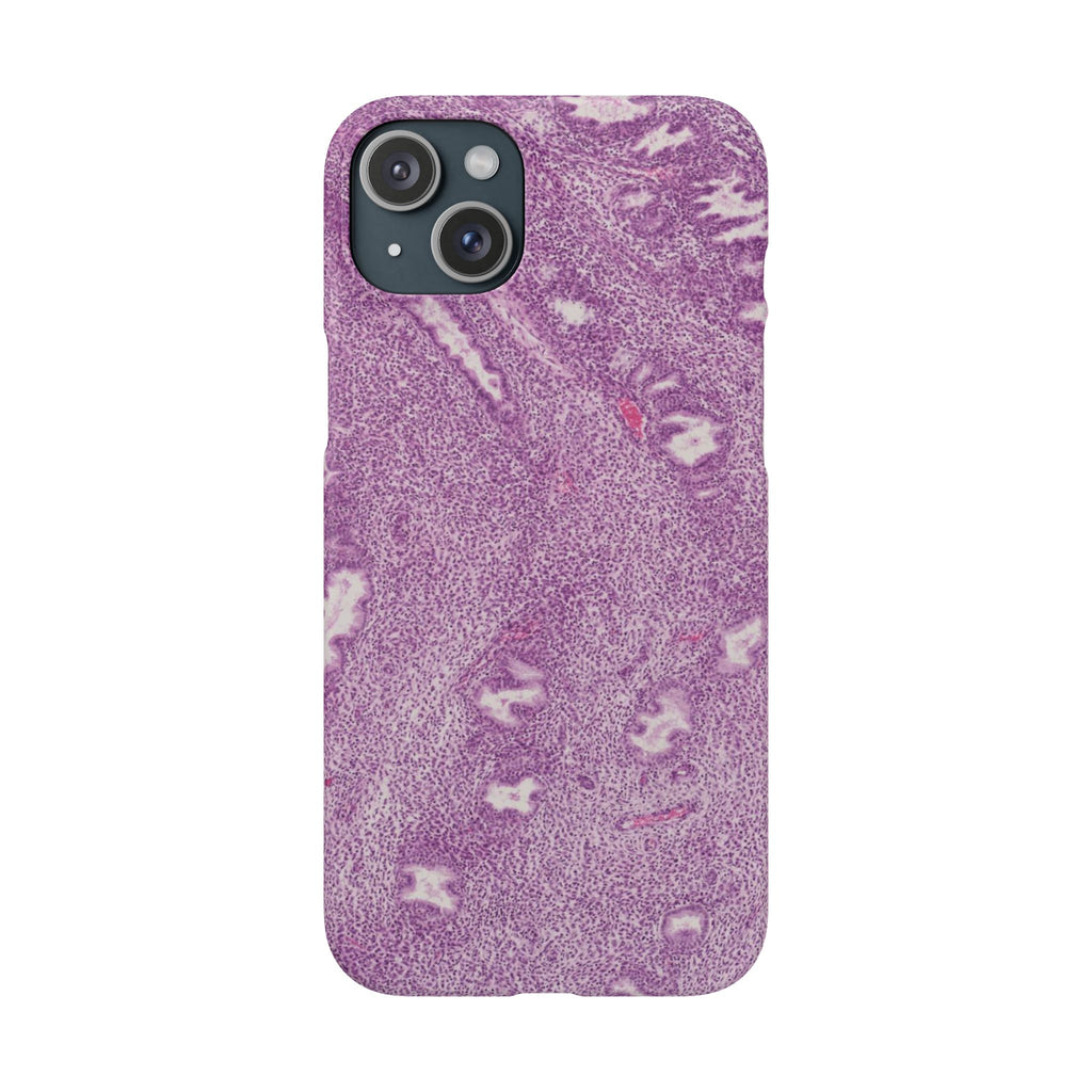 Slim Case Endometrium