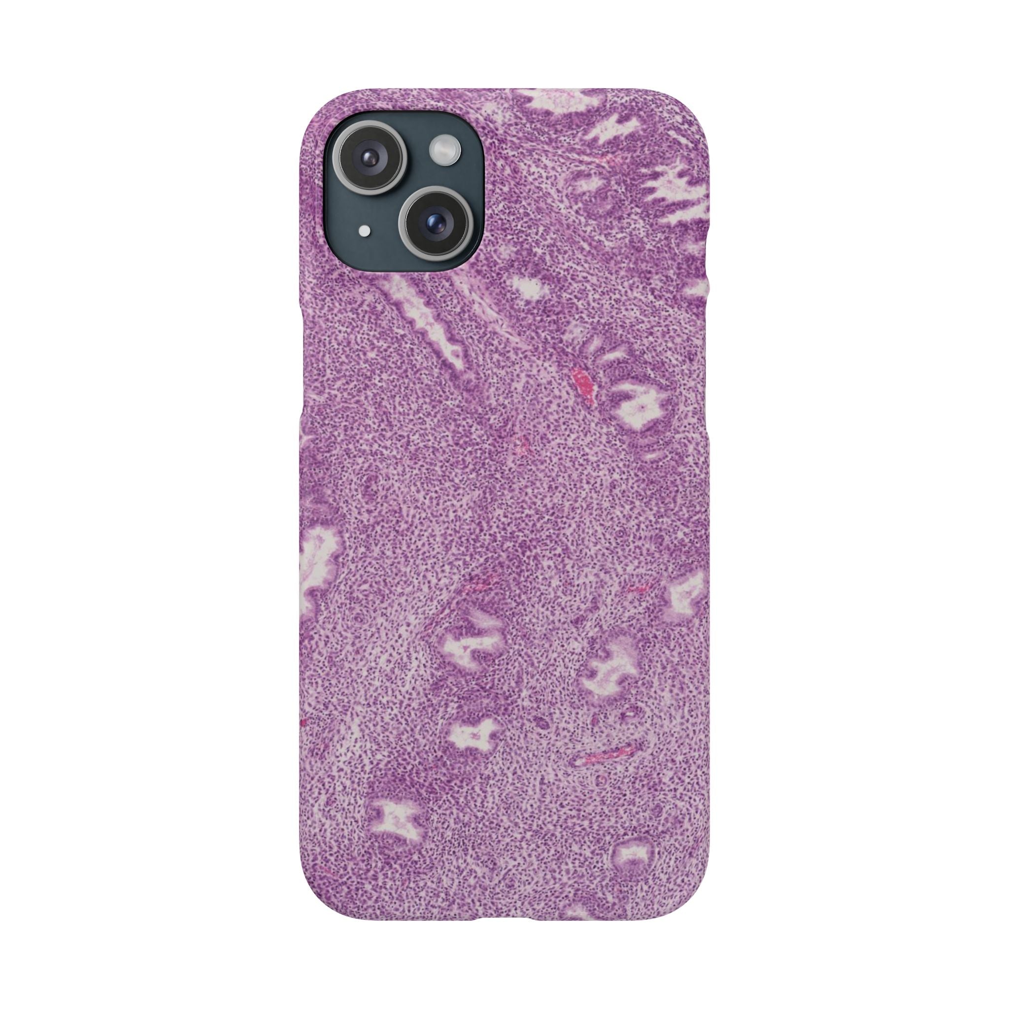 Slim Case Endometrium