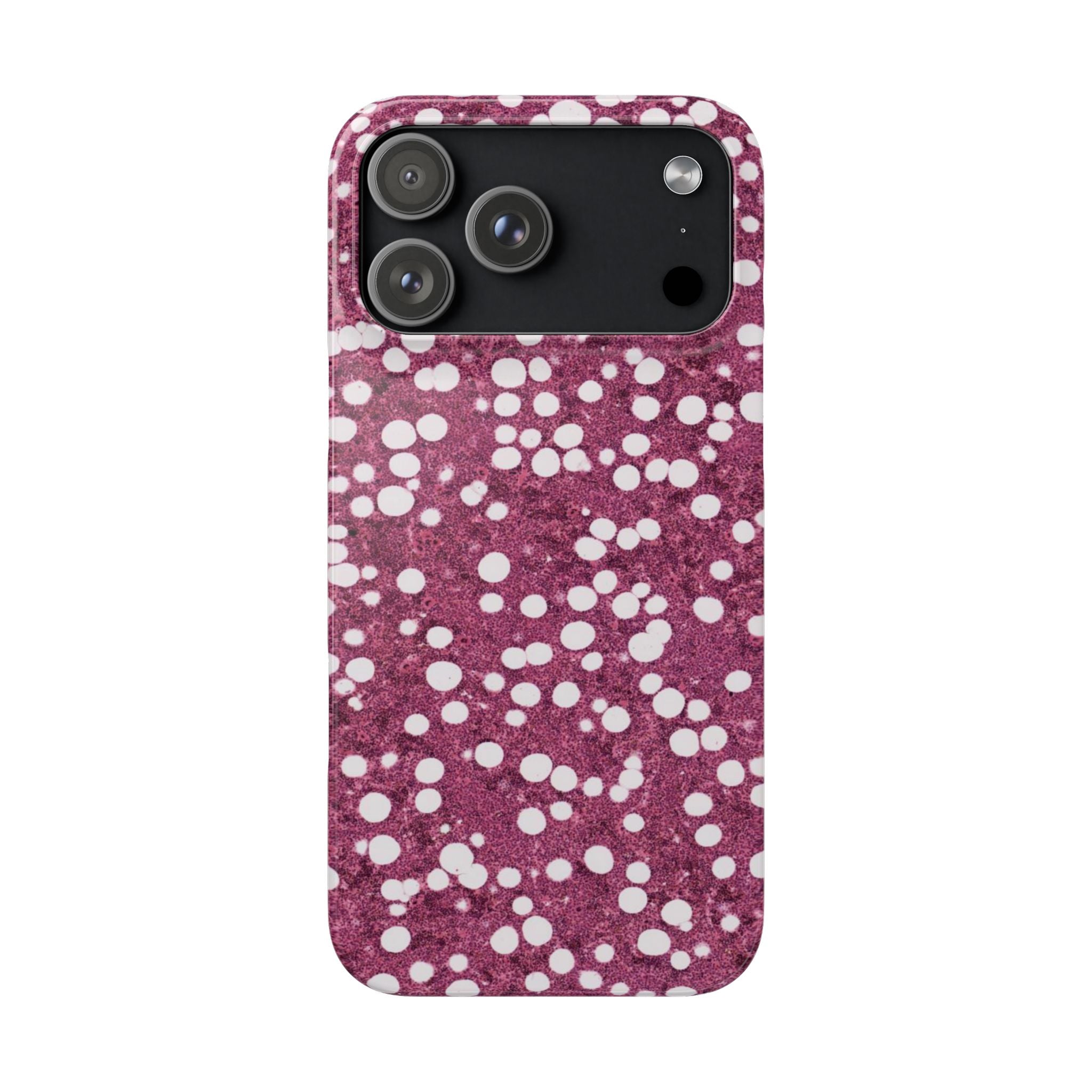 Slim Case Myelolipom