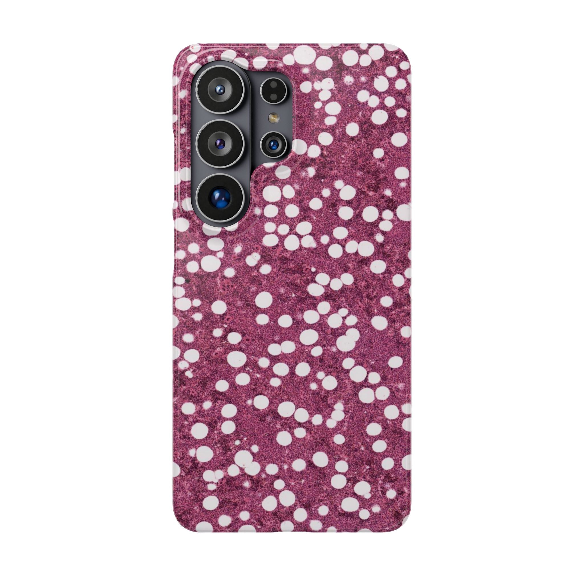 Slim Case Myelolipom