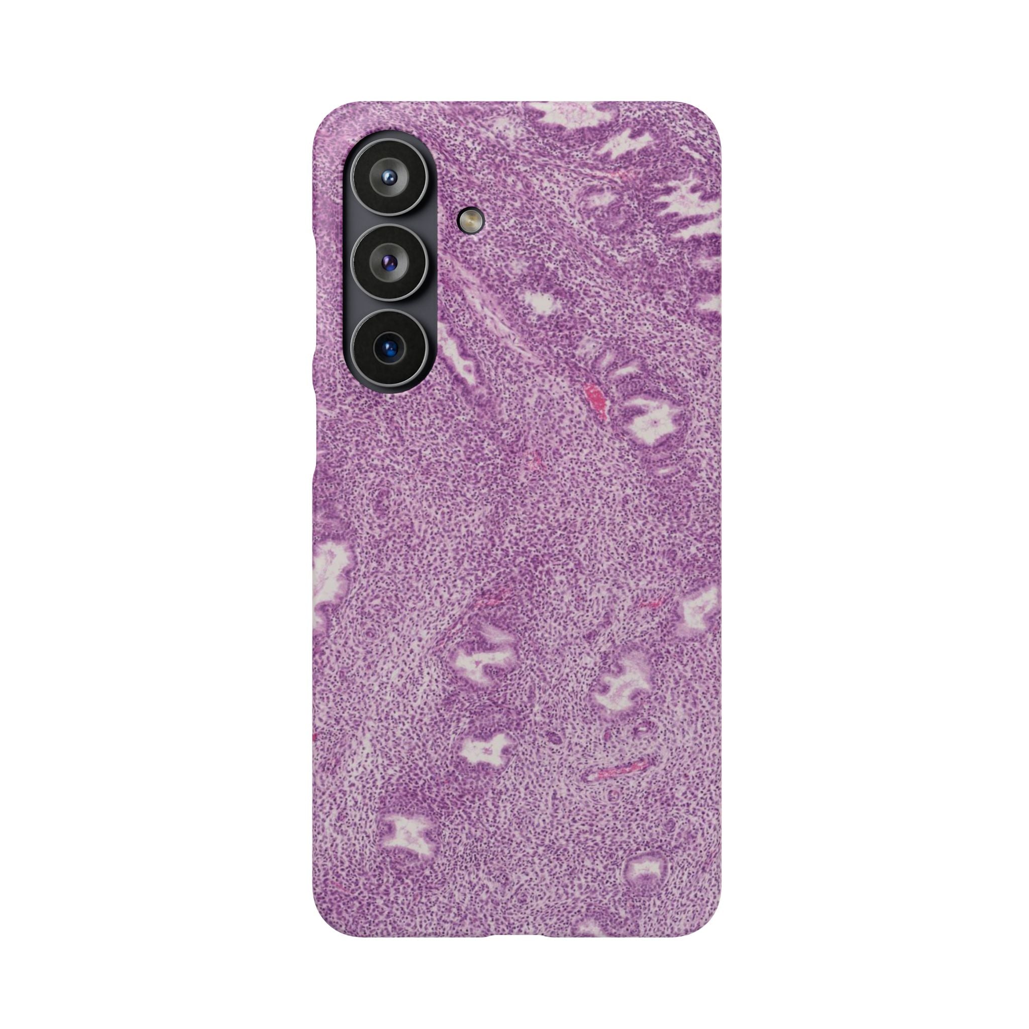 Slim Case Endometrium
