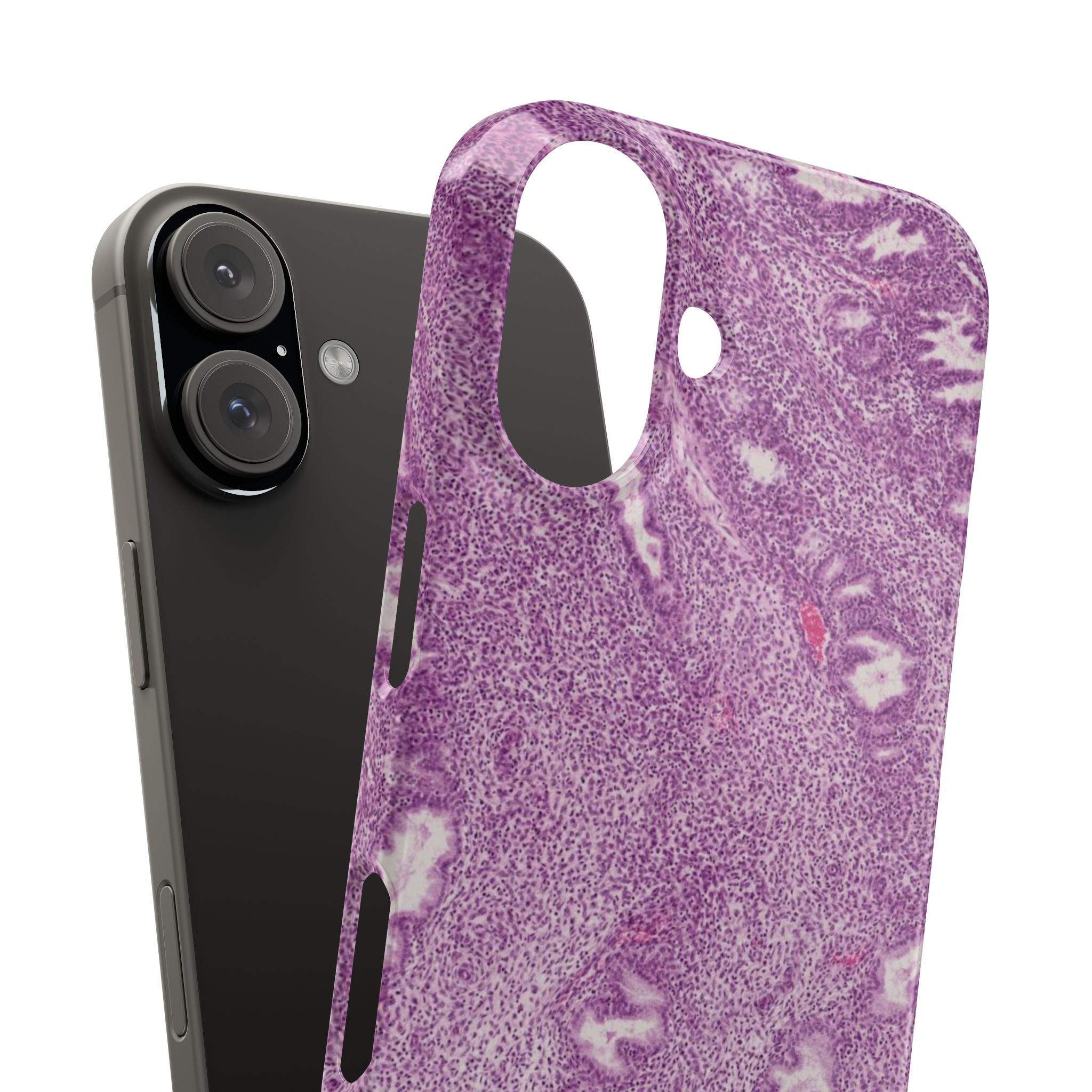 Slim Case Endometrium