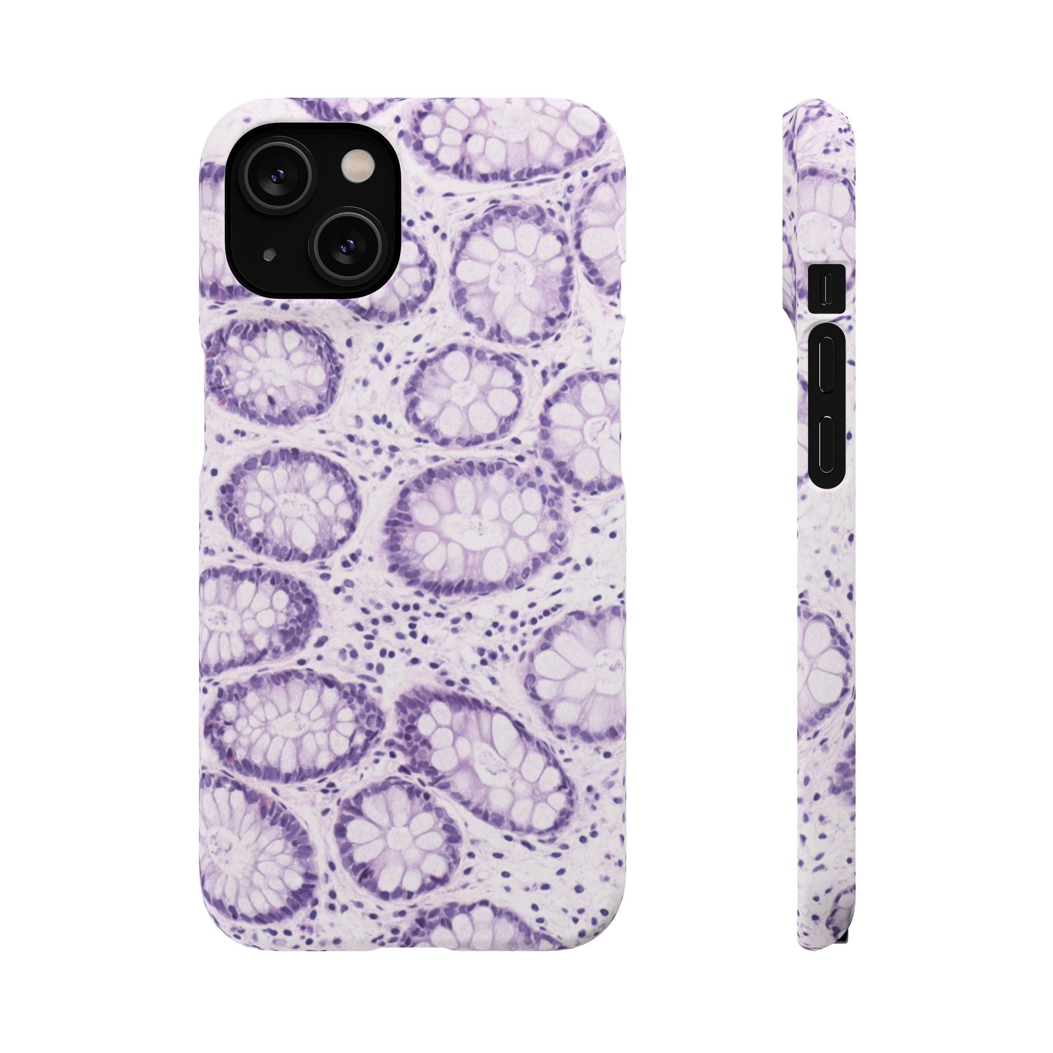 Slim Case Kolon