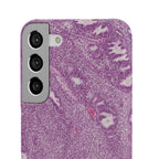 Slim Case Endometrium