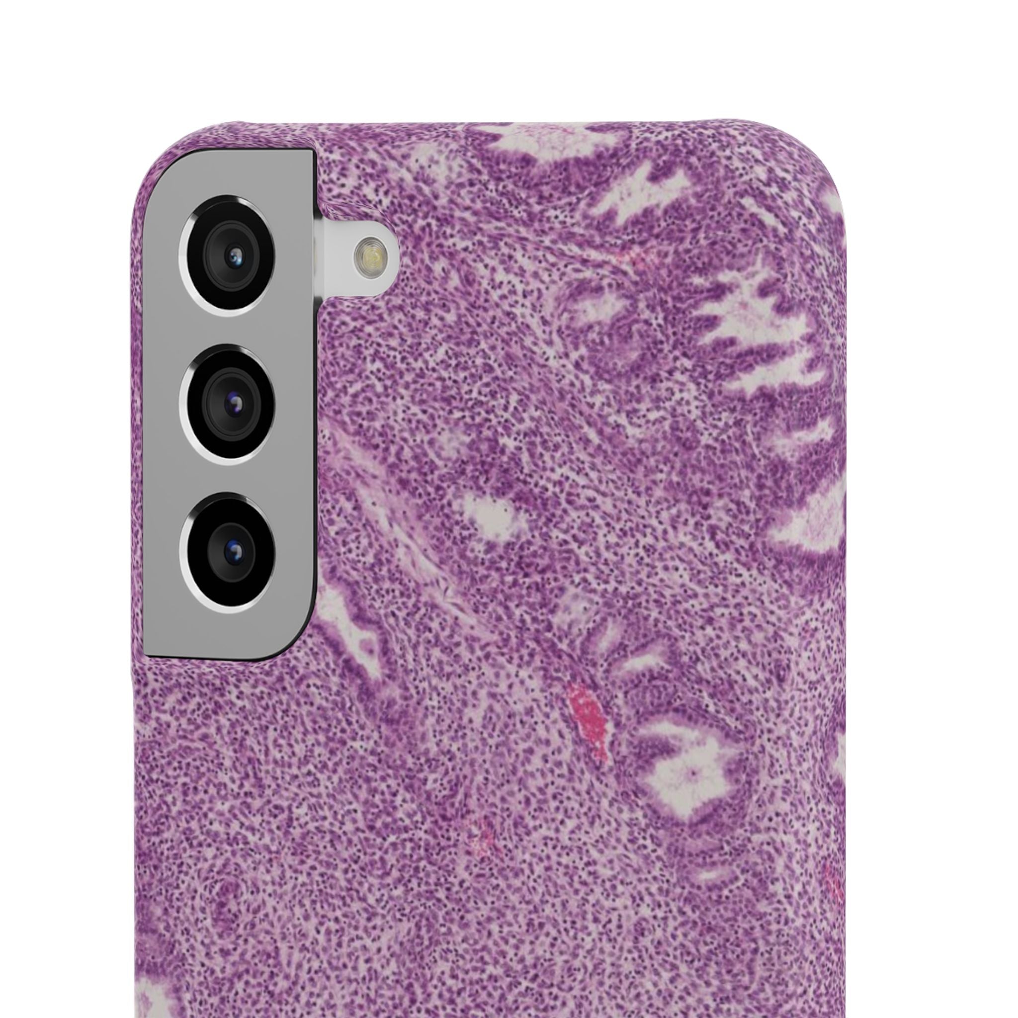 Slim Case Endometrium