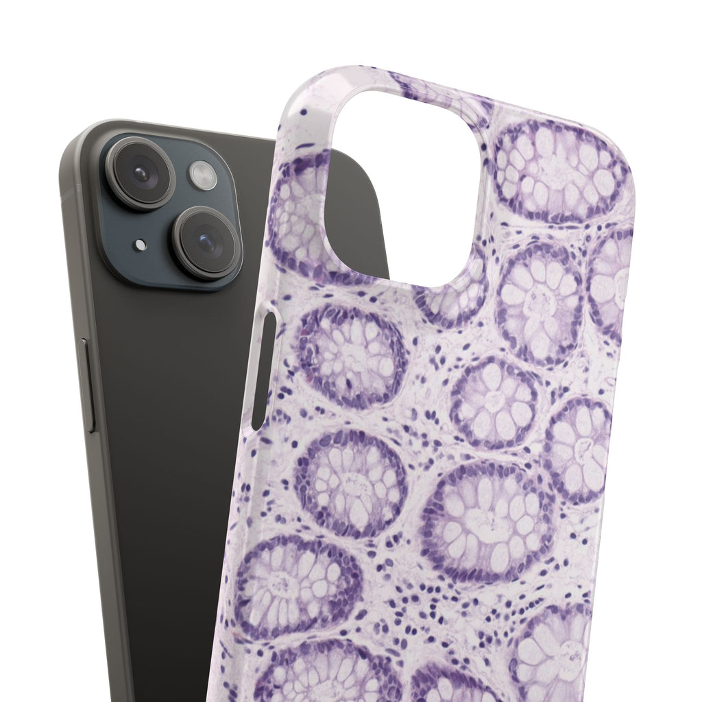 Slim Case Kolon