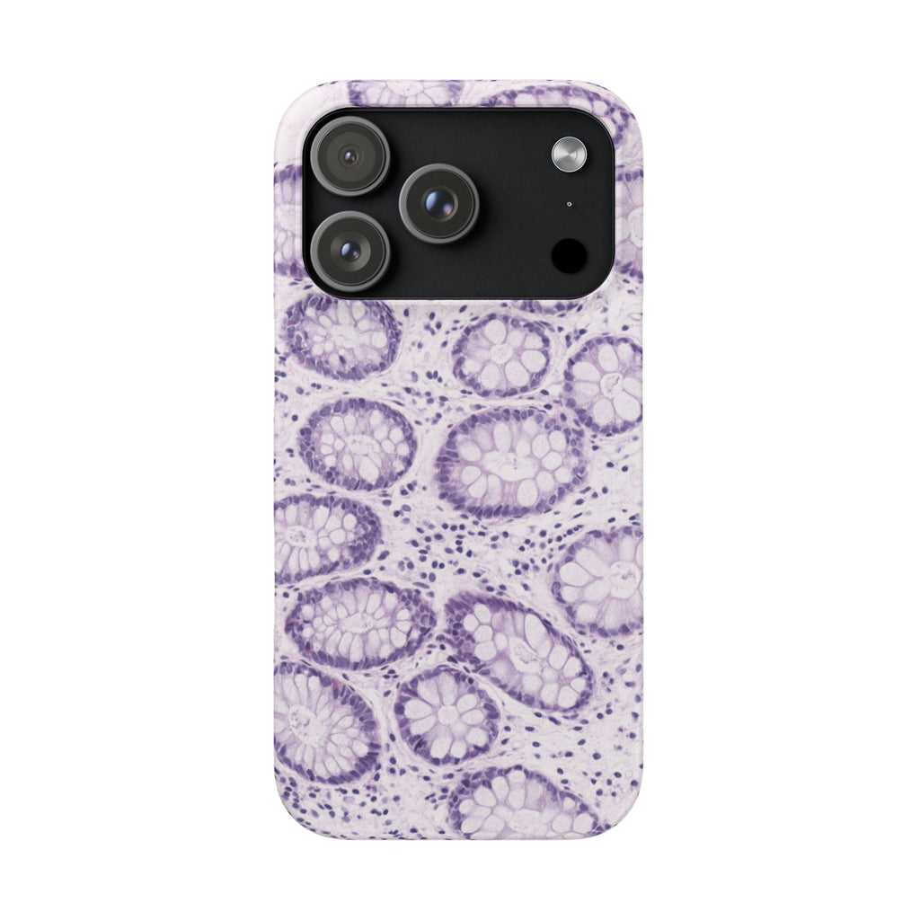 Slim Case Kolon