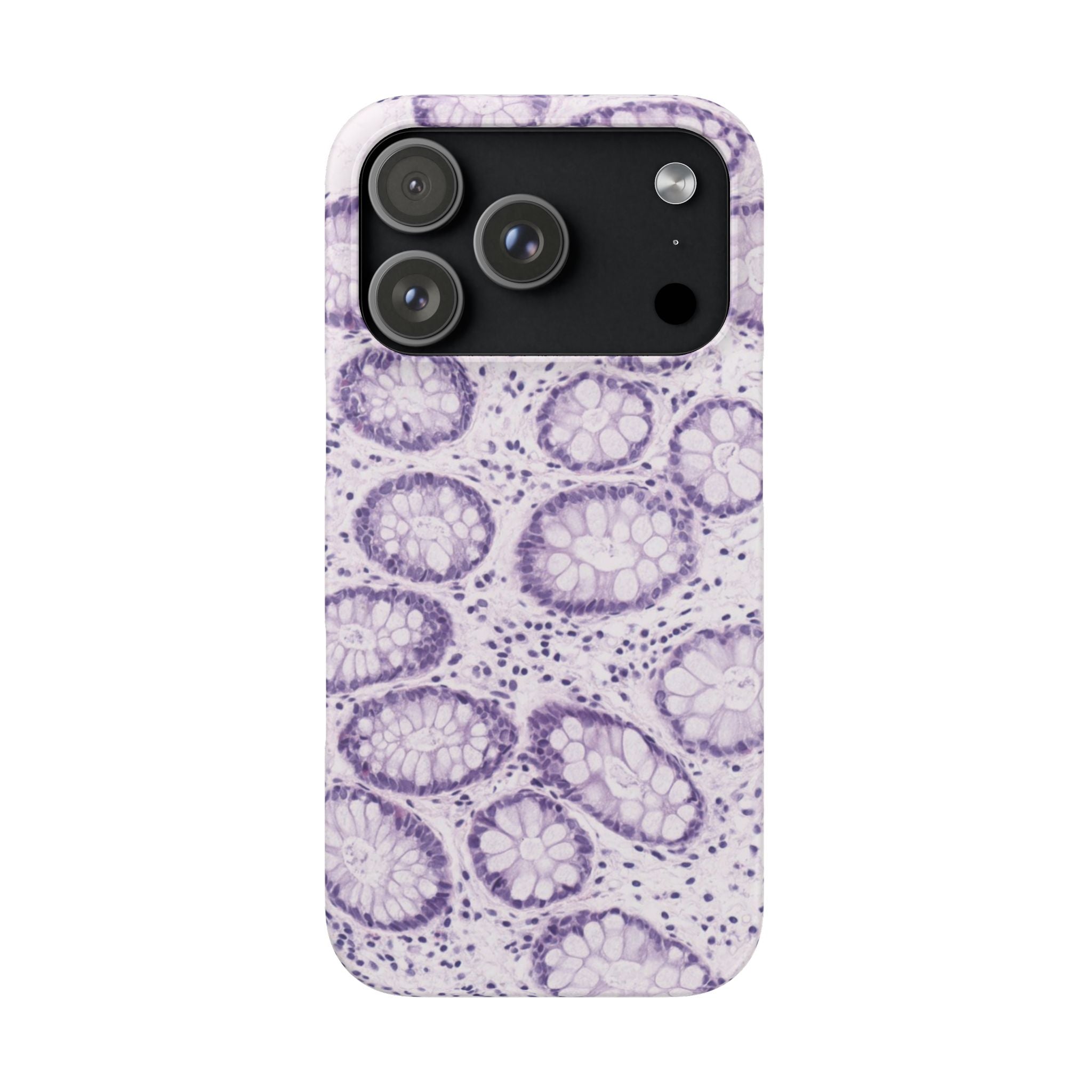 Slim Case Kolon