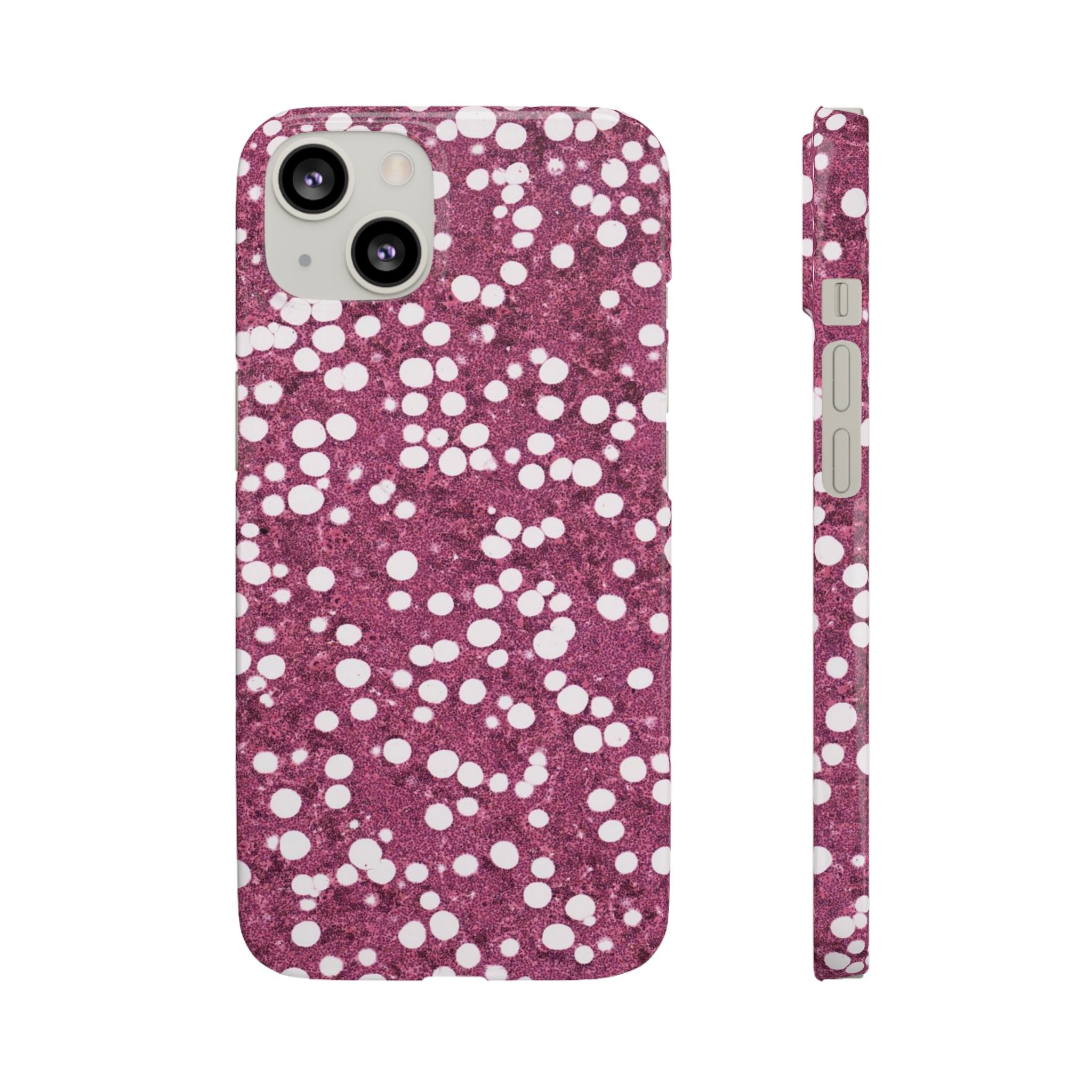 Slim Case Myelolipom