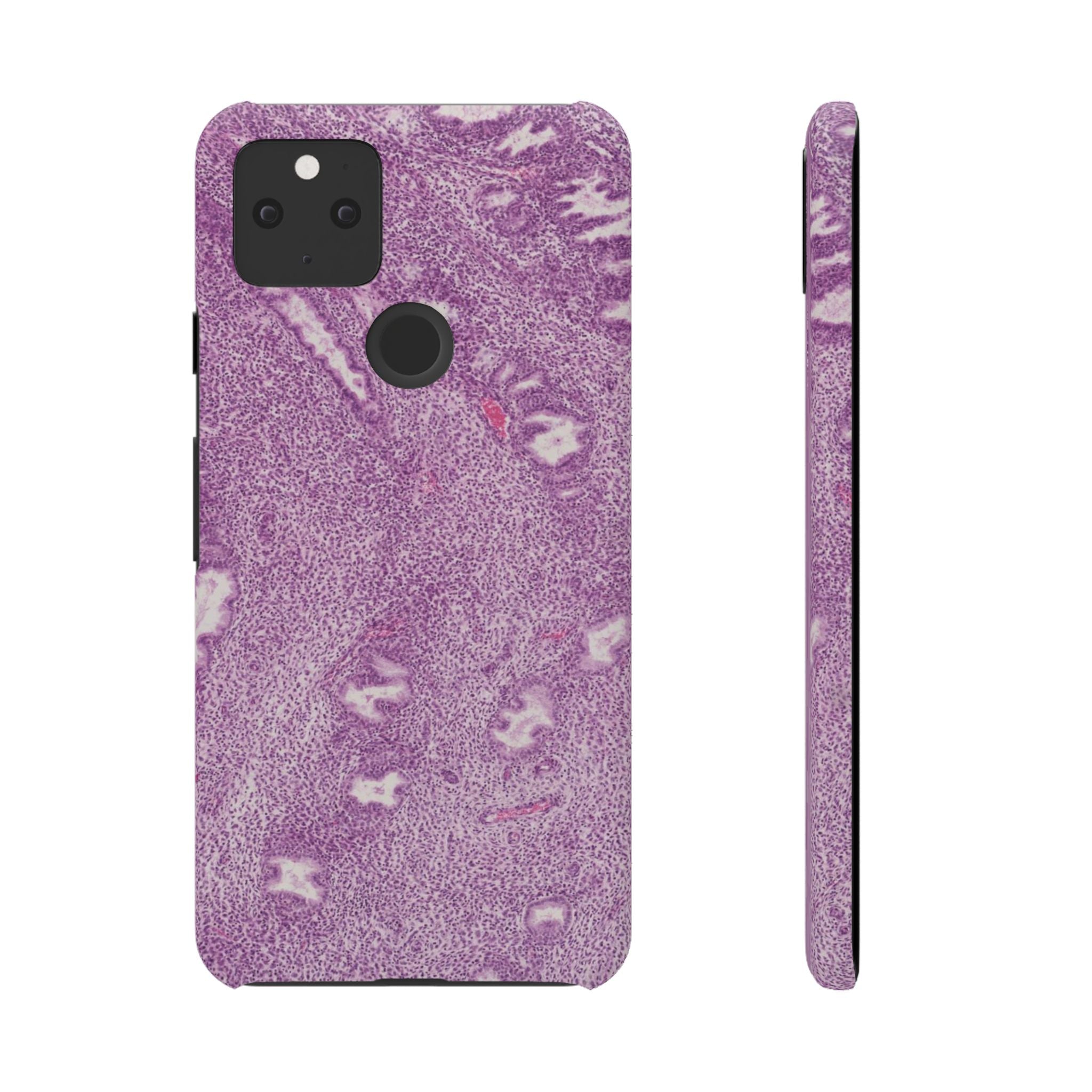 Slim Case Endometrium